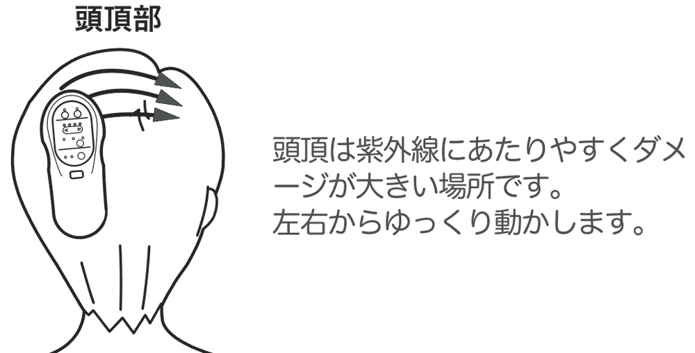 頭頂部への当て方